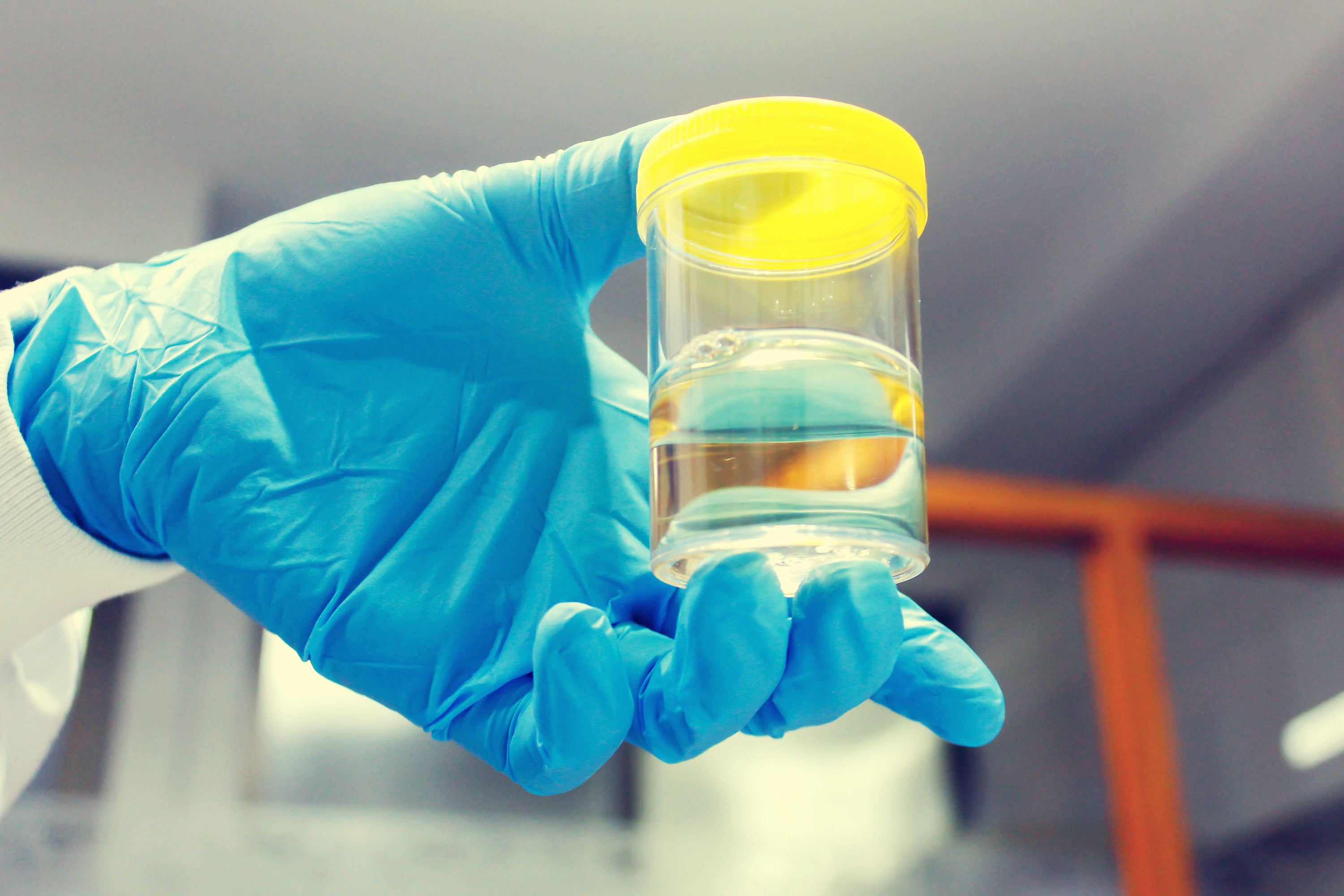 Doctor holding Urine sample in laboratory