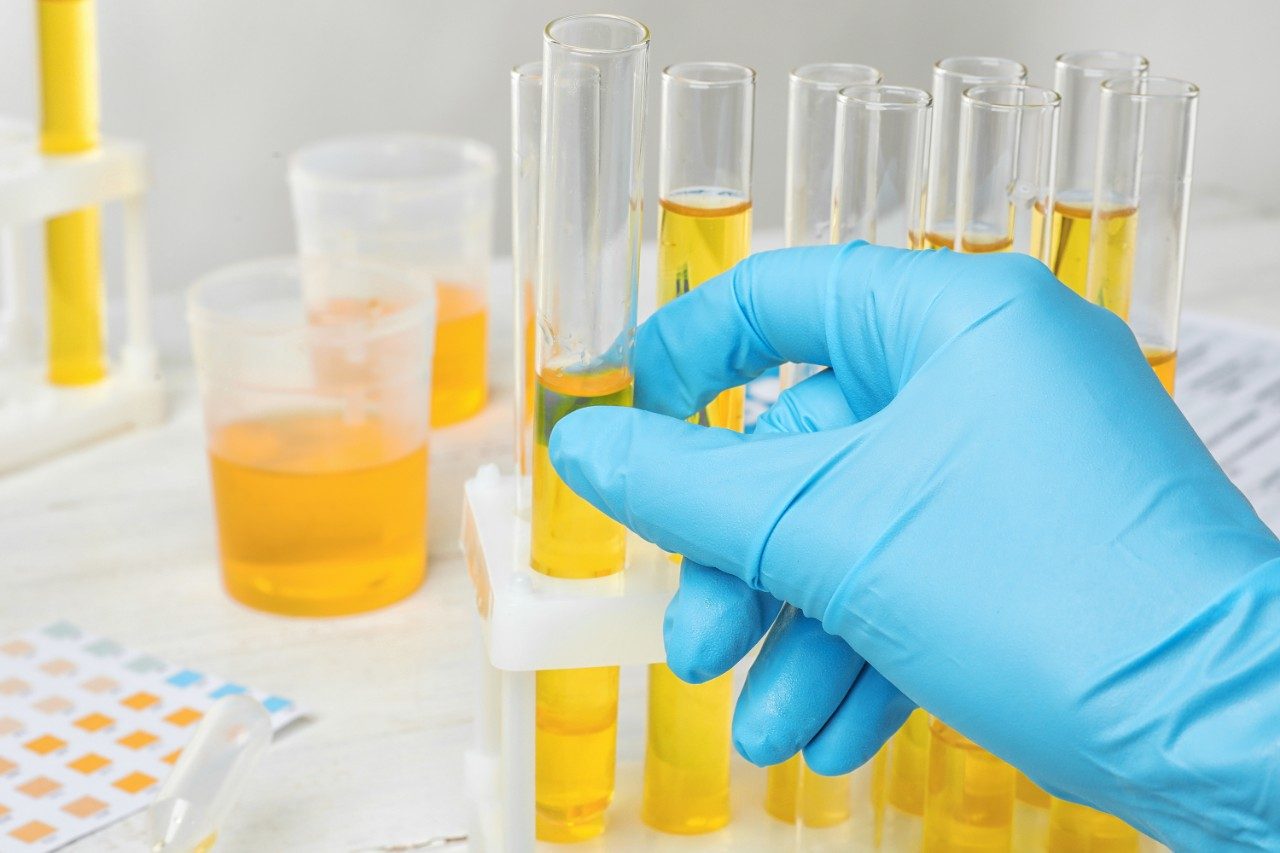 Lab worker taking test tube with urine sample